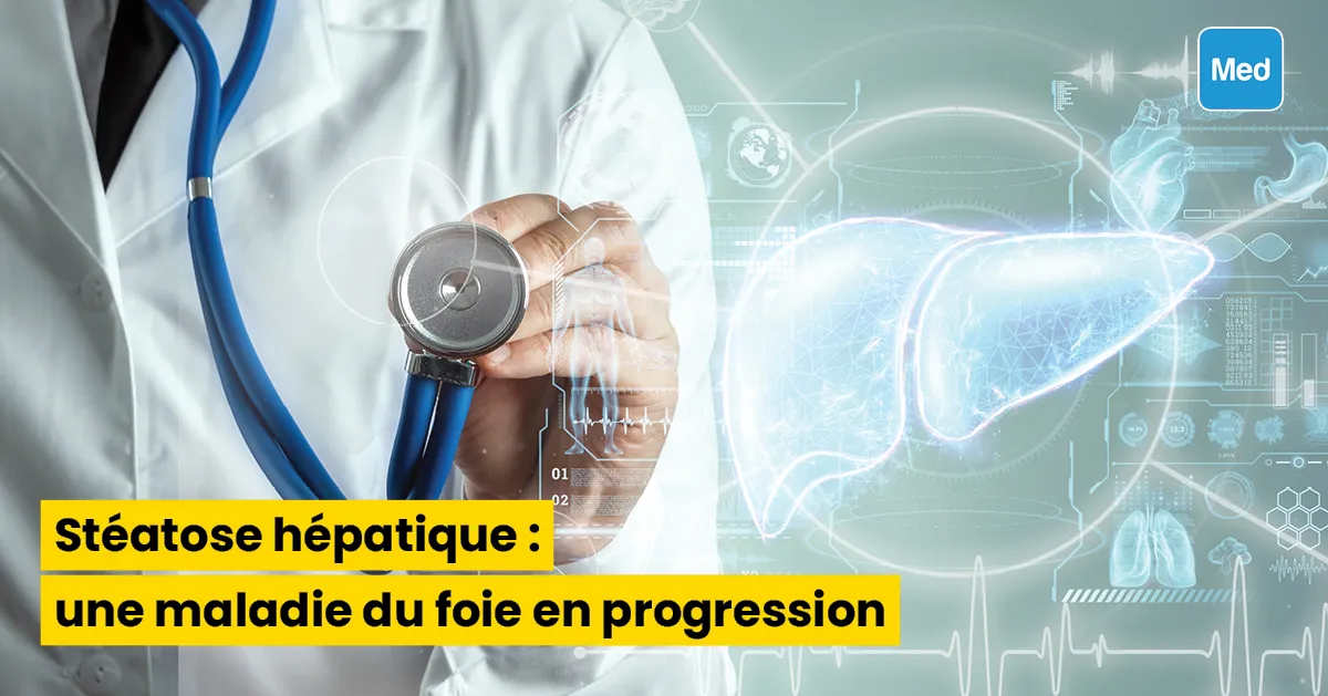 Stéatose hépatique : une maladie du foie en progression
